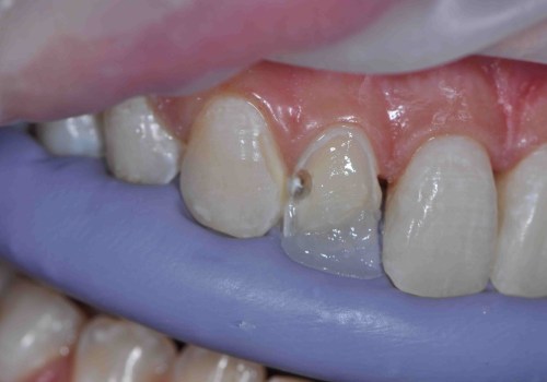 Preparing a Composite for Staining